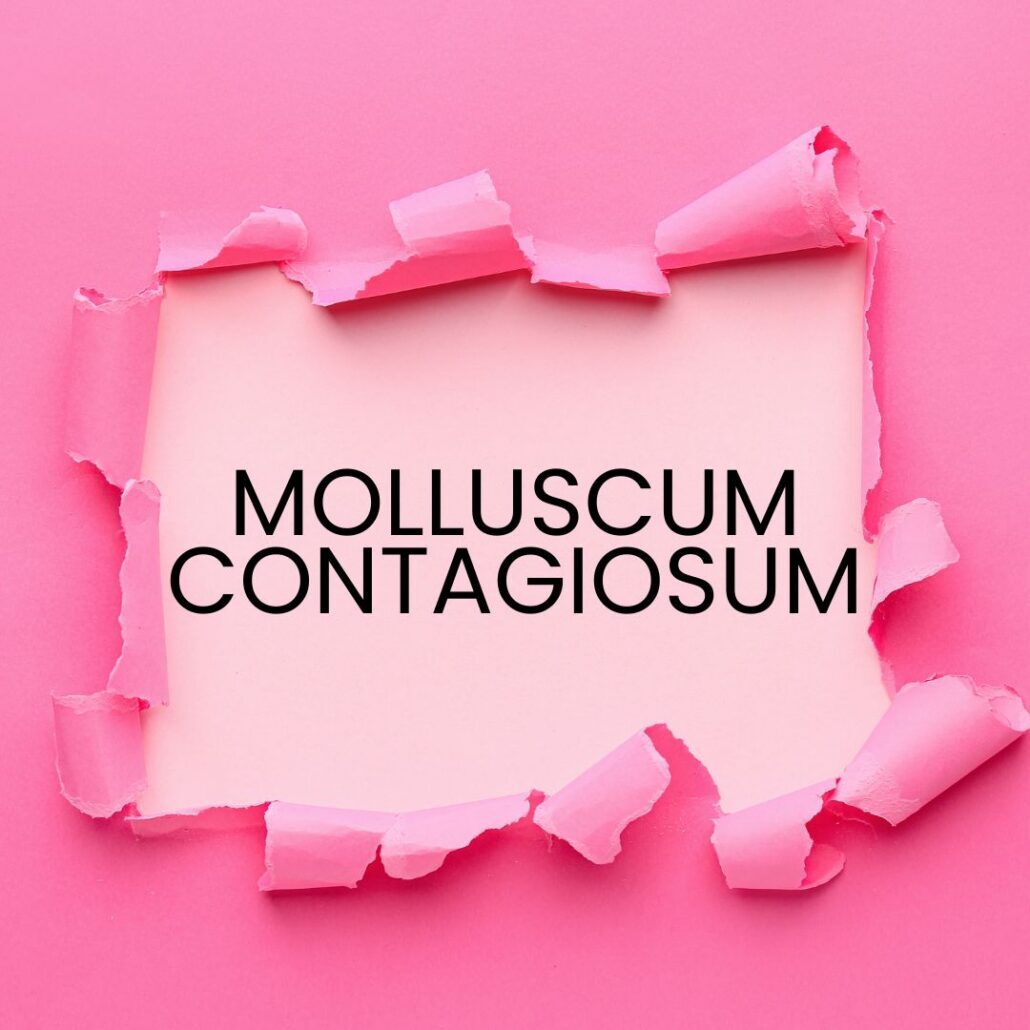 Molluscum contagiosum bumps on child's skin — Spring Valley Pediatrics Washington DC